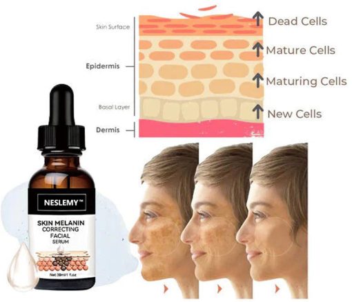 【First Order Discount】✨Fast Dark Spot Remover-NESLEMY™ Melanin Correcting Facial Serum - Image 6