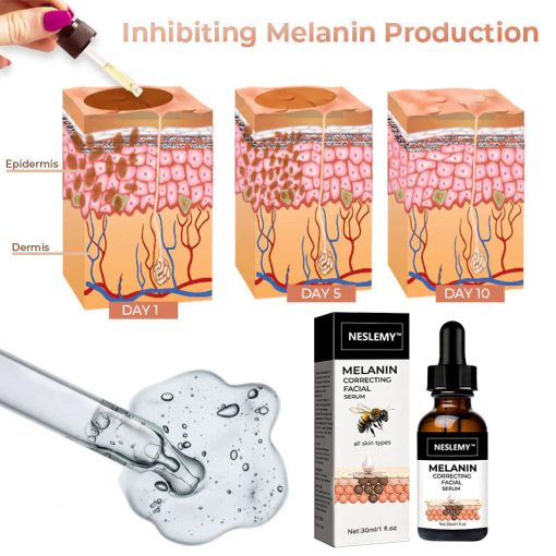 【First Order Discount】✨Fast Dark Spot Remover-NESLEMY™ Melanin Correcting Facial Serum - Image 11