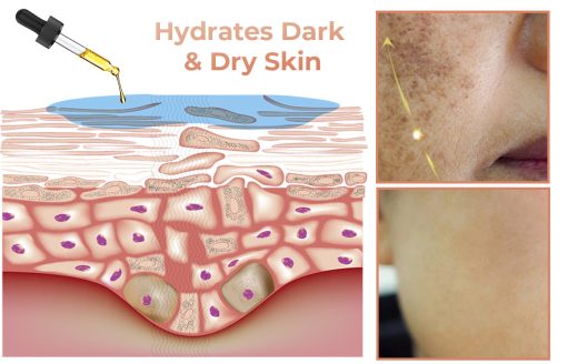 【First Order Discount】✨Fast Dark Spot Remover-NESLEMY™ Melanin Correcting Facial Serum - Image 9