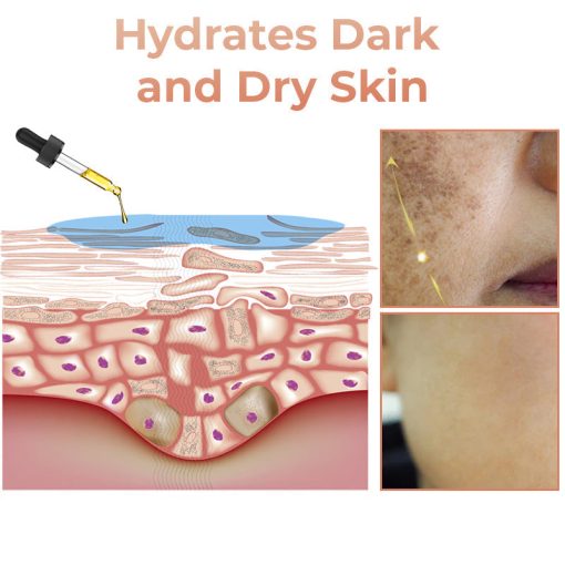 【First Order Discount】✨Fast Dark Spot Remover-NESLEMY™ Melanin Correcting Facial Serum - Image 7