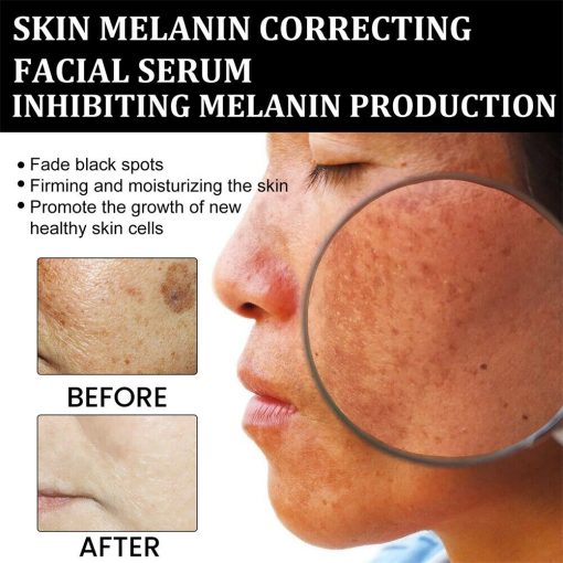 【First Order Discount】✨Fast Dark Spot Remover-NESLEMY™ Melanin Correcting Facial Serum - Image 2